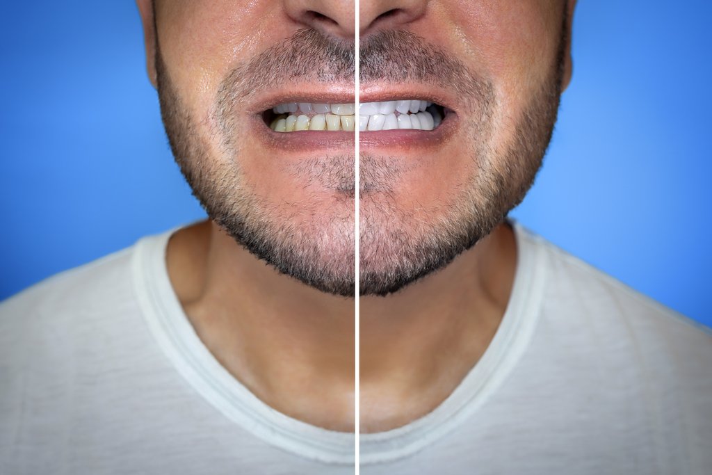 Real Before & After Results