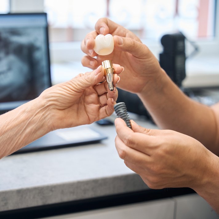 Affordable Implant Dentist Near Boynton Beach, FL
